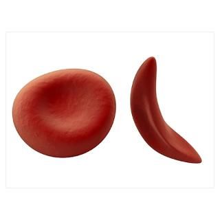Wall Art  Posters  Sickle cell Poster